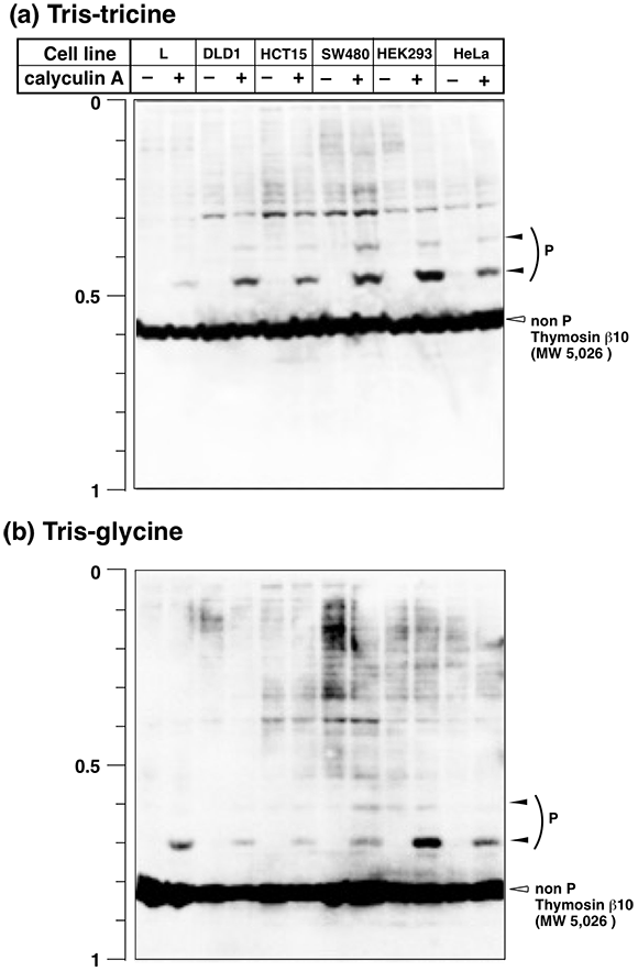 Thymosin beta10